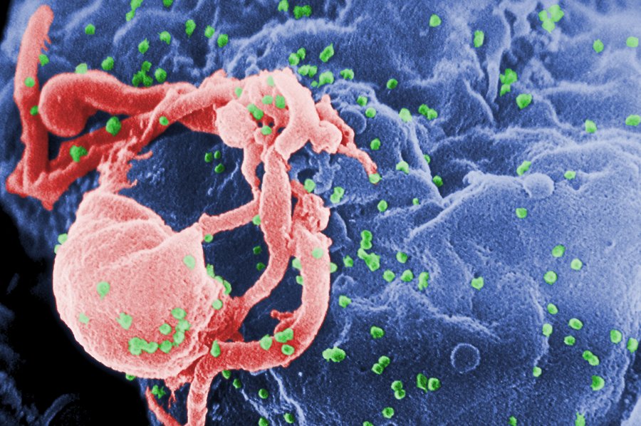 Aids - wirus HIV