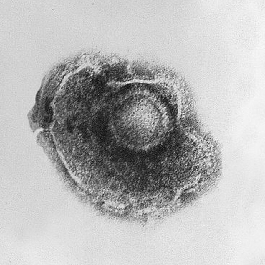 Półpasiec w ciąży – wirus